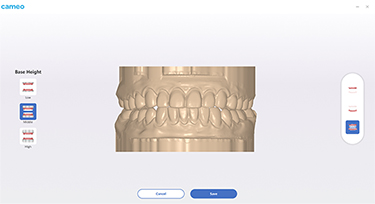 Rapid 3 Intraoral Scanner